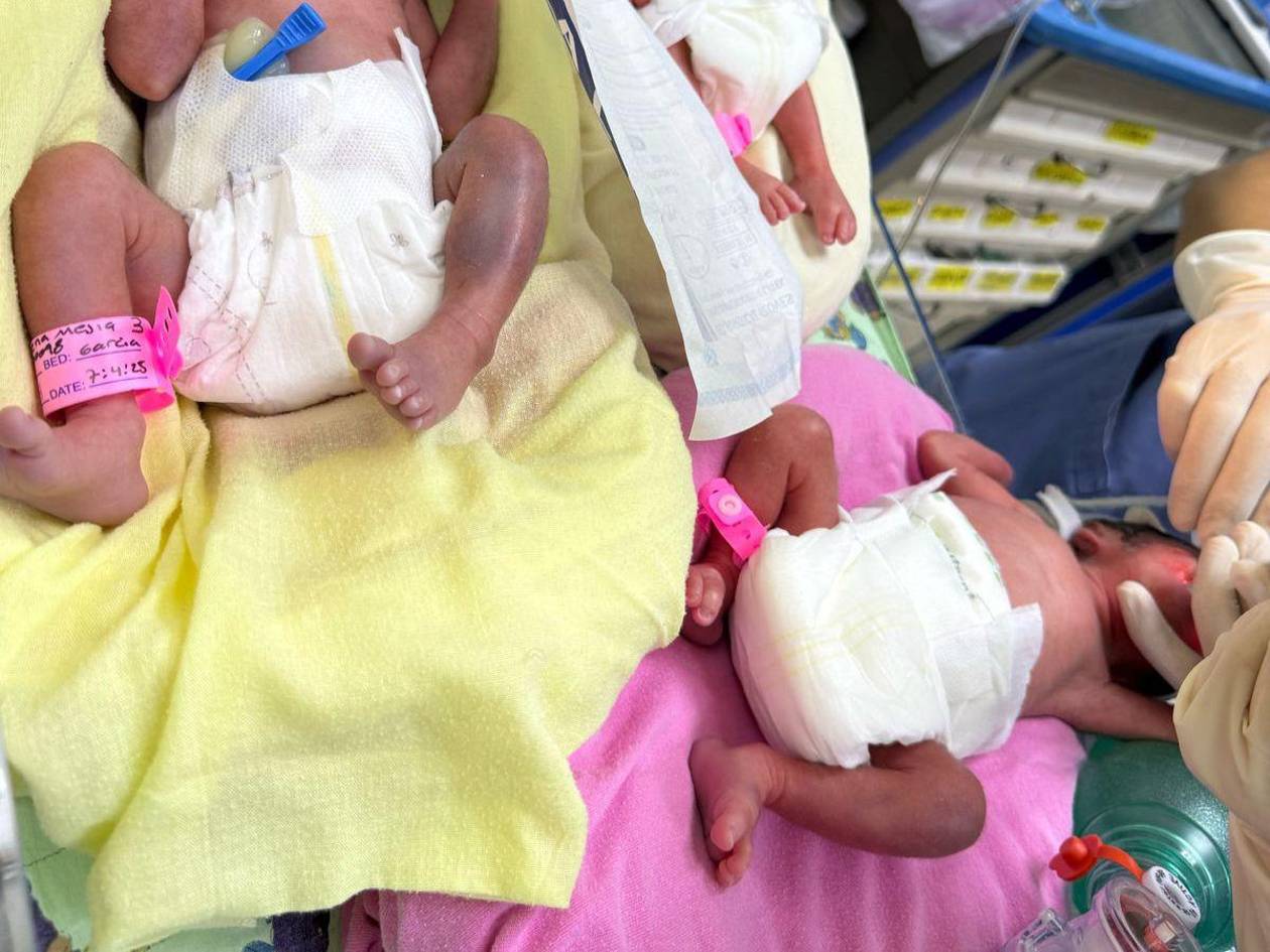 Revelan causa de muerte de trillizas que nacieron en el Mario Rivas