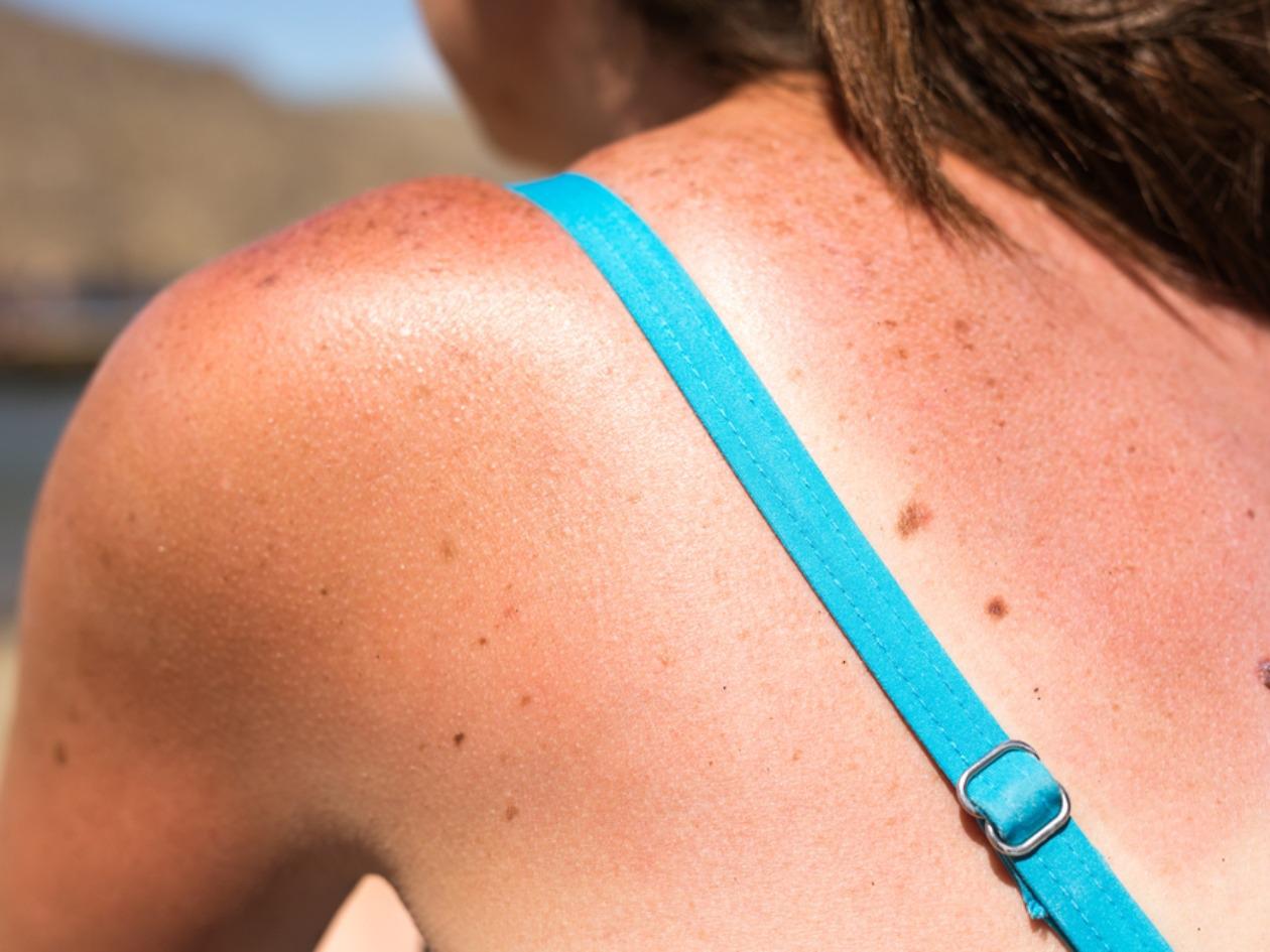 ¿Y después del sol, qué hacemos?