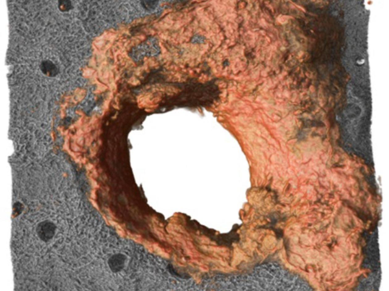 El sorprendente descubrimiento que previene infecciones en humanos