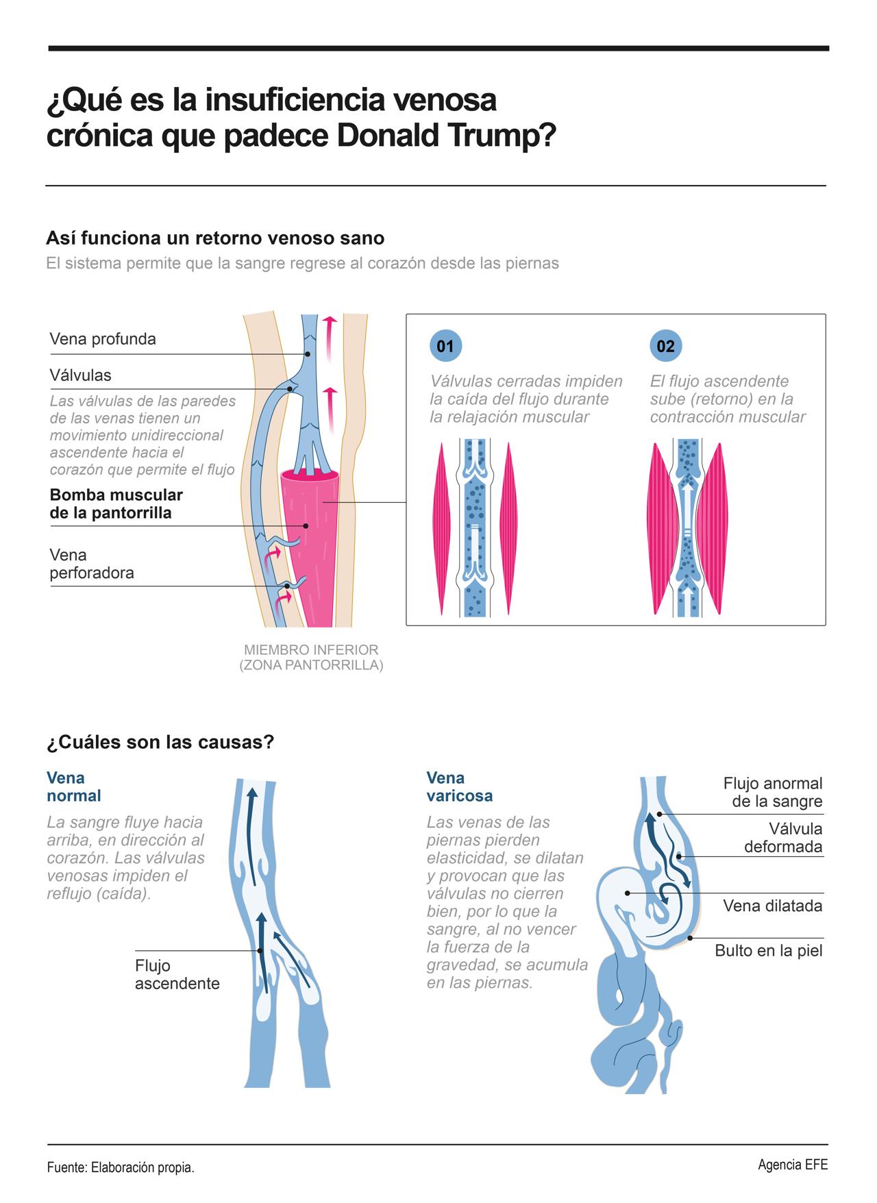 Trump no fue diagnosticado con una enfermedad mortal