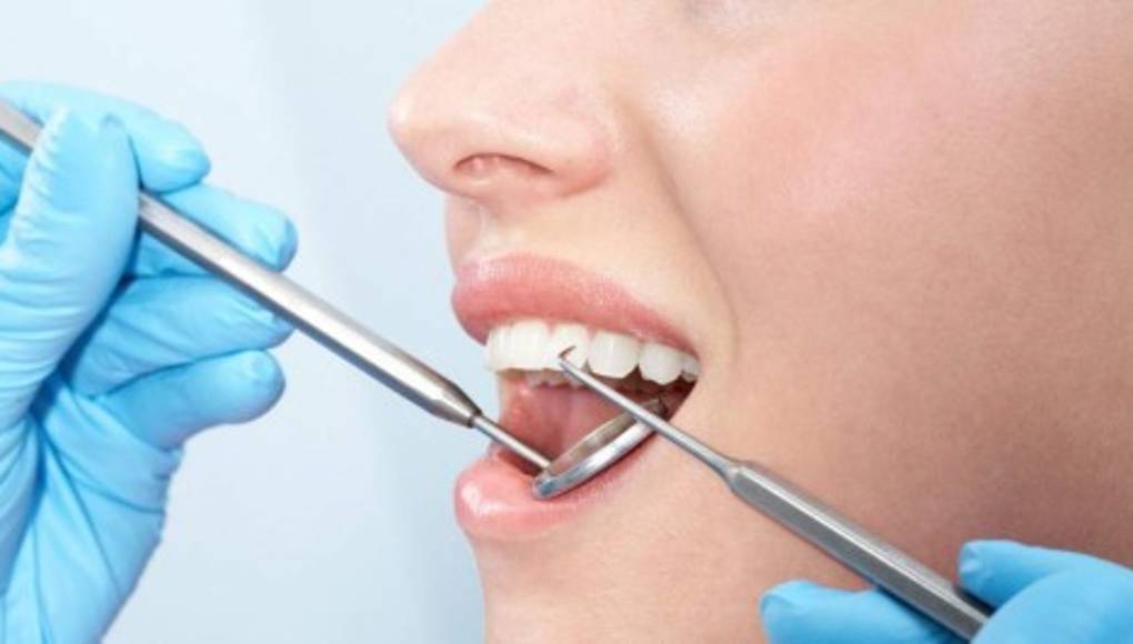 ¿Podría la falta de dientes ser una pista de una enfermedad cardiaca letal?