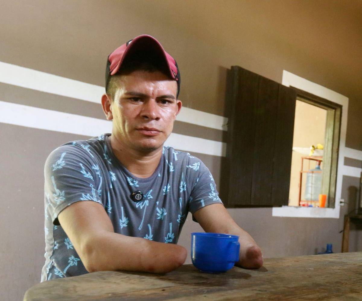 $!A Santos le cortaron sus manos y ahora inspira a otros: Ya no quiero volver atrás