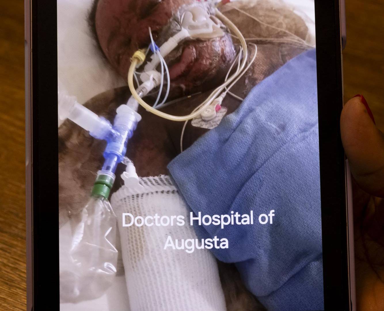 $!Marcella Townsend pasó más de seis semanas en coma tras sufrir quemaduras. Su rostro estaba irreconocible. (Kendrick Brinson para The New York Times)