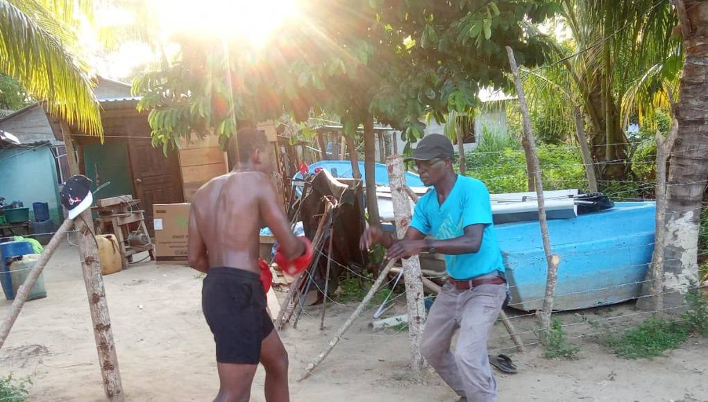 “Creo que todo inició desde hace 6 años, ahí por 2018. Fue un día de un eclipse mundial, yo lo quería ver y no había nada por la TV, tenía unos anteojos de sol y estaba muy nublado, no se podía ver. Trataba de ver el sol y volví a mi casa, luego escucho en las noticias que ver el eclipse era malo. Pero después de eso yo comencé a sentir los problemas en los ojos, ya miraba borroso”, reveló como anécdota.