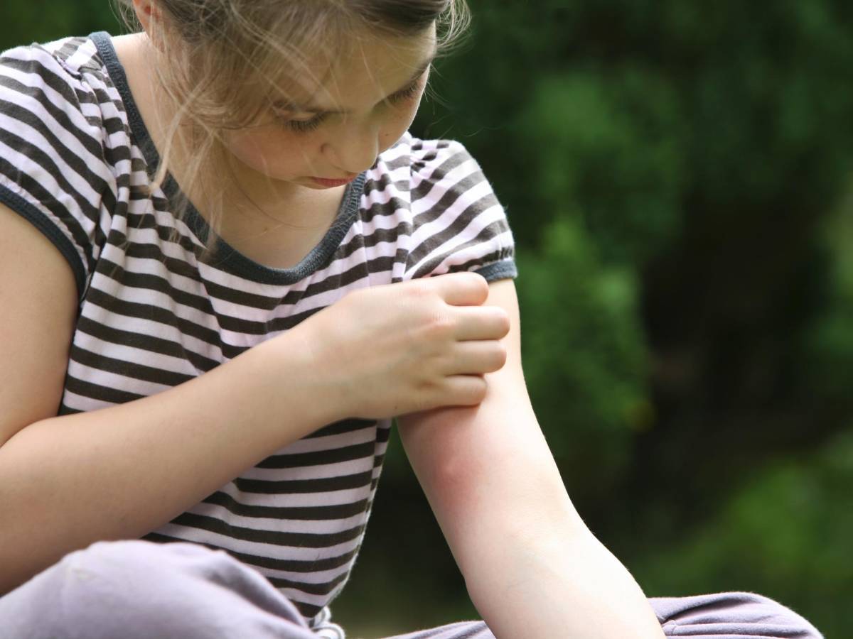 ¿Por qué nos pican los zancudos?