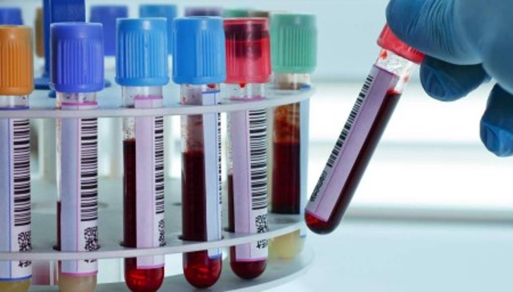 Un análisis de sangre descubre todos los virus que han afectado a una persona