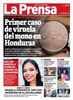 Primer caso de viruela del mono en Honduras