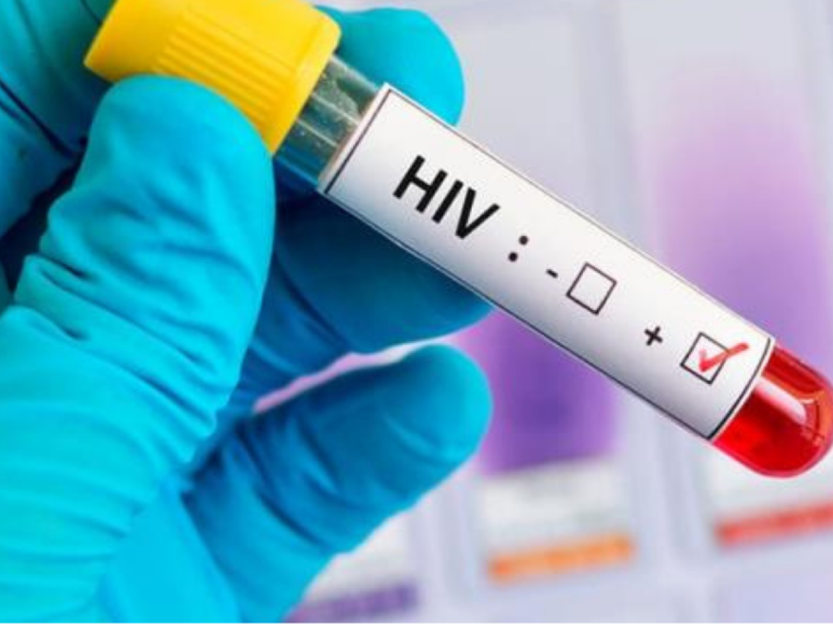 Más de 2,000 casos de VIH reportan autoridades del SAI en La Ceiba