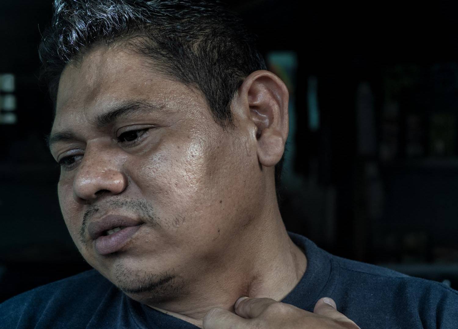 $!Nöe del Cid, que quedó parcialmente paralizado por un disparo, ha visto mejorar su vecindario en El Salvador desde que el Presidente Nayib Bukele comenzó su represión contra las pandillas.