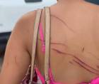 Imagen de la víctima agredida por la pareja.
