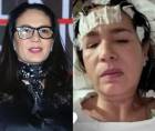 En días recientes la salud de la conductora de televisión, Yolanda Andrade, ha vuelto a la conversación de los medios de la farándula.
