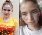 Una hondureña de 23 años fue capturada en la colonia La Unión, en Tegucigalpa, acusada de fingir su propio secuestro en dos ocasiones para obtener dinero de su pareja sentimental y utilizar inteligencia artificial (IA) para fabricar imágenes de lesiones y documentos hospitalarios falsos.