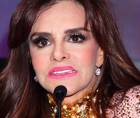 Lucía Méndez preocupó a sus seguidores tras su accidente en el escenario de su show “Vedette”.