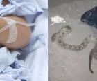 El menor fue ingresado de inmediato y permanece bajo observación médica mientras especialistas evalúan su condición clínica.