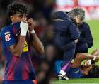 Lamine Yamal se lesionó este miércoles luego de anotar un gol ante el Celta de Vigo.