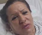 La diputada permanece hospitalizada en Tegucigalpa.
