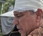 Nelson Andino denunció formalmente a su hijo por maltrato familiar, luego de agredirlo y ser atendido en el hospital Atlántida.