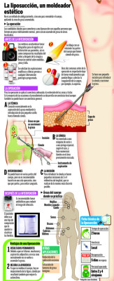 La liposucción no se aplica para personas obesas