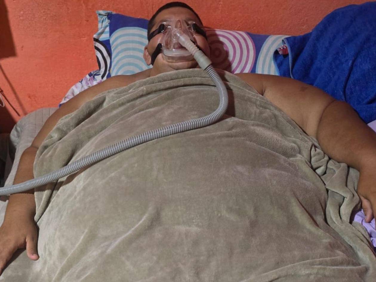 El sobrepeso le comenzó a generar problemas de respiración.