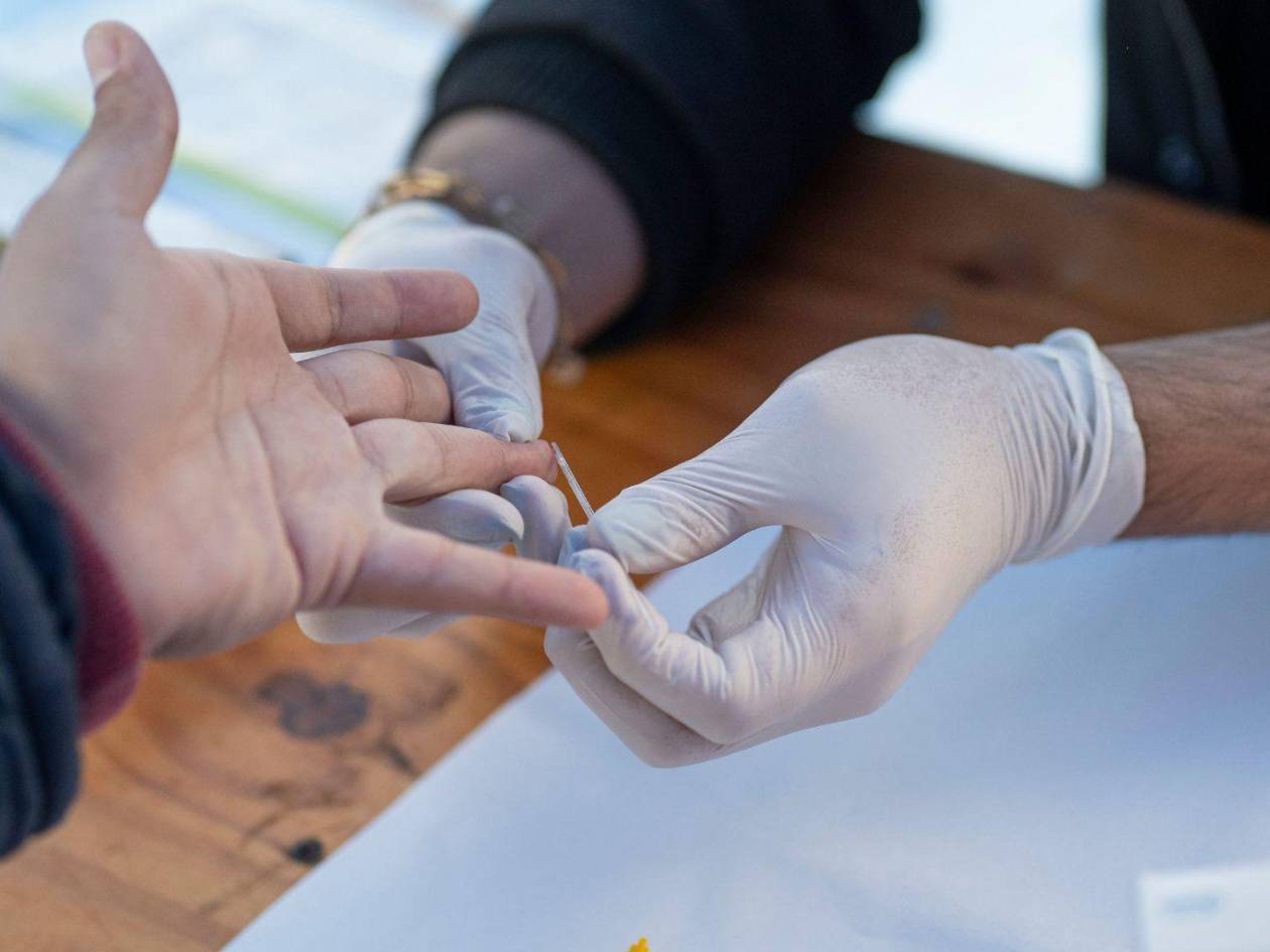 El VIH (Virus de Inmunodeficiencia Humana) es el virus responsable de la infección, mientras que el Sida (Síndrome de Inmunodeficiencia Adquirida) representa la etapa más avanzada de la enfermedad.