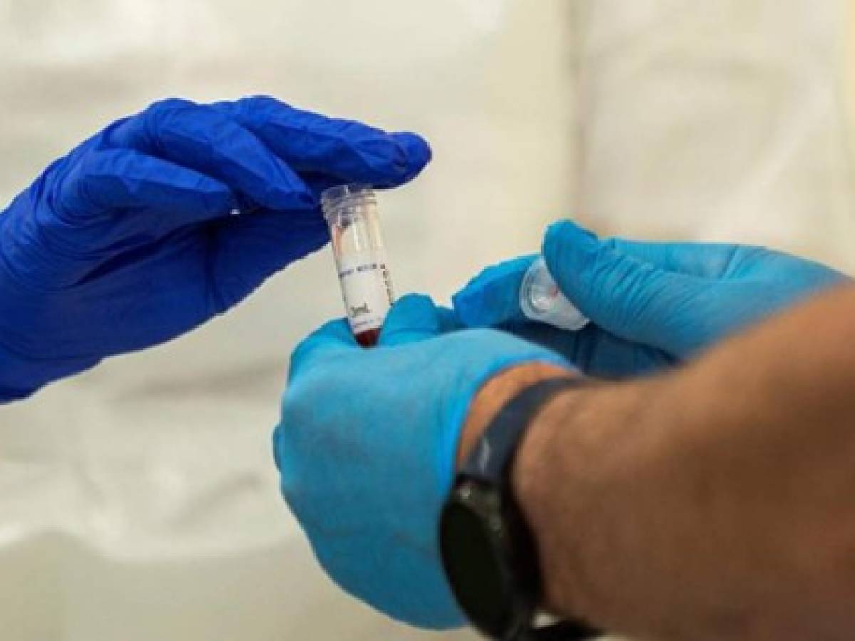 No da tregua: casos de coronavirus en el mundo ascienden a 47 millones