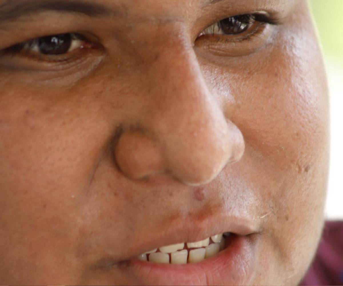 <b>Su estilo de vida lo llevó a ser internado en el Catarino Rivas y a perder la vesícula biliar.</b>