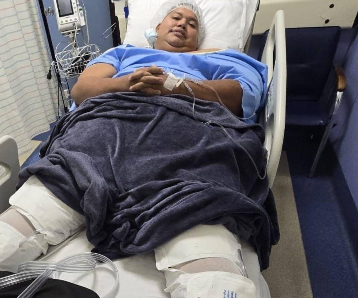 Elder previo a entrar al quirófano para someterse a la cirugía que le cambió la vida.