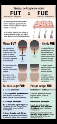 Trasplante capilar en Honduras: 9 cosas que debes saber