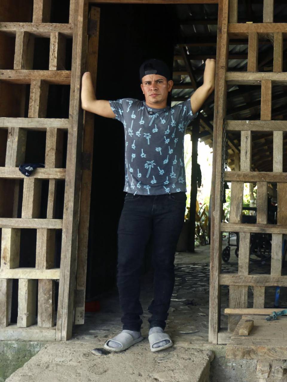 A Santos le cortaron sus manos y ahora inspira a otros: Ya no quiero volver atrás