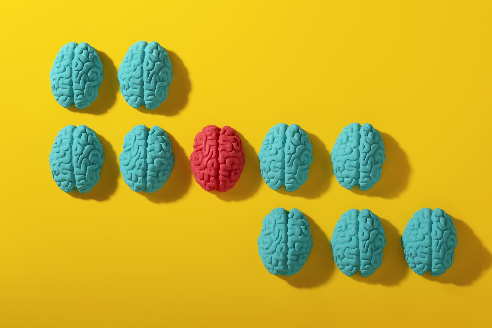 Algunas investigaciones intentan dilucidar en qué diferencia el cerebro de una persona con múltiples personalidades o con un comportamiento anómalo del perteneciente a una persona considerada normal.