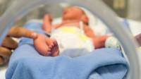 En los recién nacidos muy prematuros la función de algunos órganos es pobre, pero mejora a medida que los estos maduran.