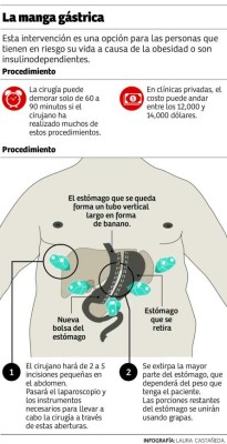 Practican cirugías para combatir la obesidad