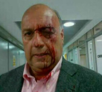 Venezuela: Niegan palabra a diputados opositores y los agraden en sesión