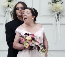 Hombre con trasplante de cara se casó