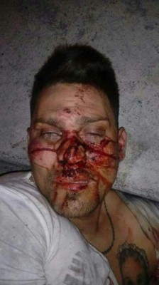 Exjugador mexicano se encuentra grave tras recibir golpiza en centro penal