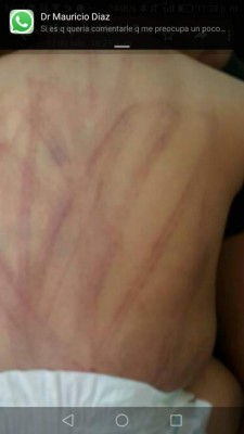 Investigan a quinceañera por azotar a su bebé con cables