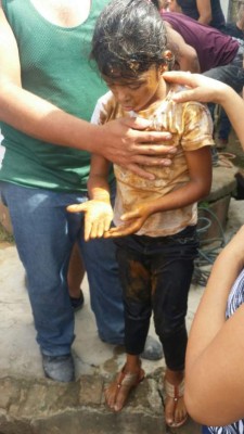Bomberos rescatan a niña que cayó en un pozo de 20 metros en Danlí