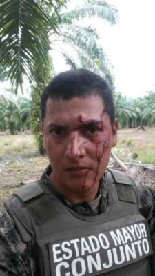 Supuestos invasores hieren a subteniente