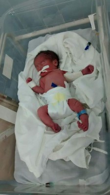 Dos partos de trillizos ha habido este mes en el Rivas