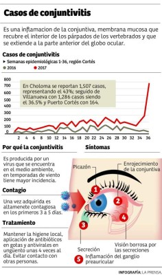 En los trabajos es donde hay más contagio de conjuntivitis