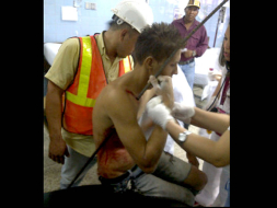 Se salva de morir tras ser atravesado por una varilla de hierro