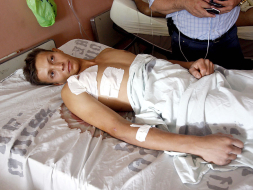 Se salva de morir tras ser atravesado por una varilla de hierro