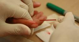 la falta de prevención, el mejor aliado del vih