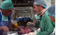 Honduras: Nacen siamesas en San Pedro Sula