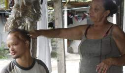 'El hombre pescado” sobrevivió a bala en la cabeza