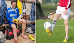 Fifa autorizó a futbolista amputado de una pierna a jugar con prótesis