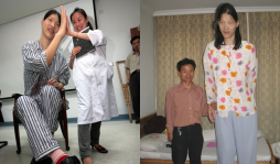 Murió la mujer más alta del mundo que medía 2,33 metros