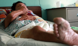 'Con la bacteria 'comecarne” es como vivir en el infierno”