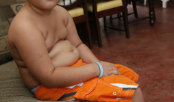 Malos hábitos alimenticios afectan a sampedranos