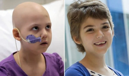 Con virus de VIH curan leucemia en niña de 7 años